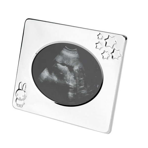 Rámeček na ultrazvuk Miffy