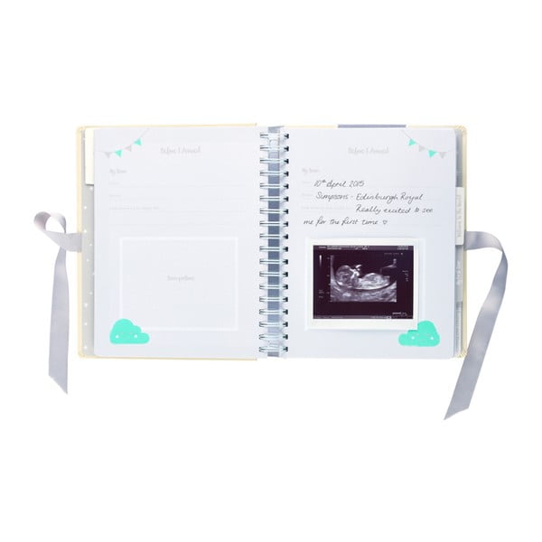 Raseduse päevik Raseduse päevik - Busy B-image-4